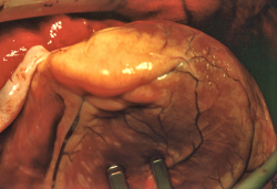 Cantabria ante su peor enemigo.Dr. Jos&eacute; Manuel Revuelta  Catedr&aacute;tico de Cirug&iacute;a. Profesor Em&eacute;rito de la Universidad de Cantabria