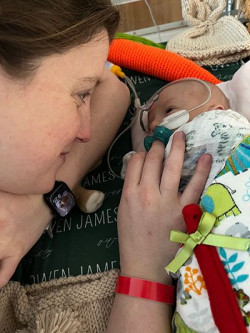 Primer trasplante de coraz&oacute;n parcial del mundo  Dr. Jos&eacute; Manuel Revuelta  Catedr&aacute;tico de Cirug&iacute;a. Profesor Em&eacute;rito de la Universidad de Cantabria  